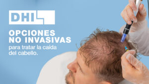 Opciones no Invasivas para Tratar la Caída del Cabello