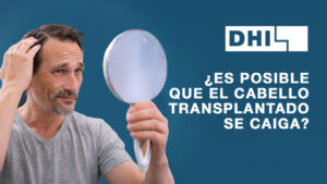 ¿Es Posible que el Cabello Trasplantado se Caiga?
