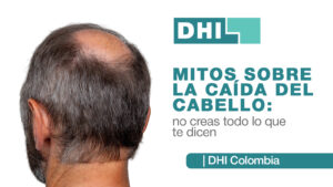 Mitos sobre Caída del Cabello: Verdades DHI Colombia