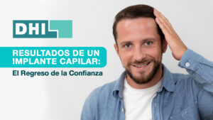 Resultados implante capilar