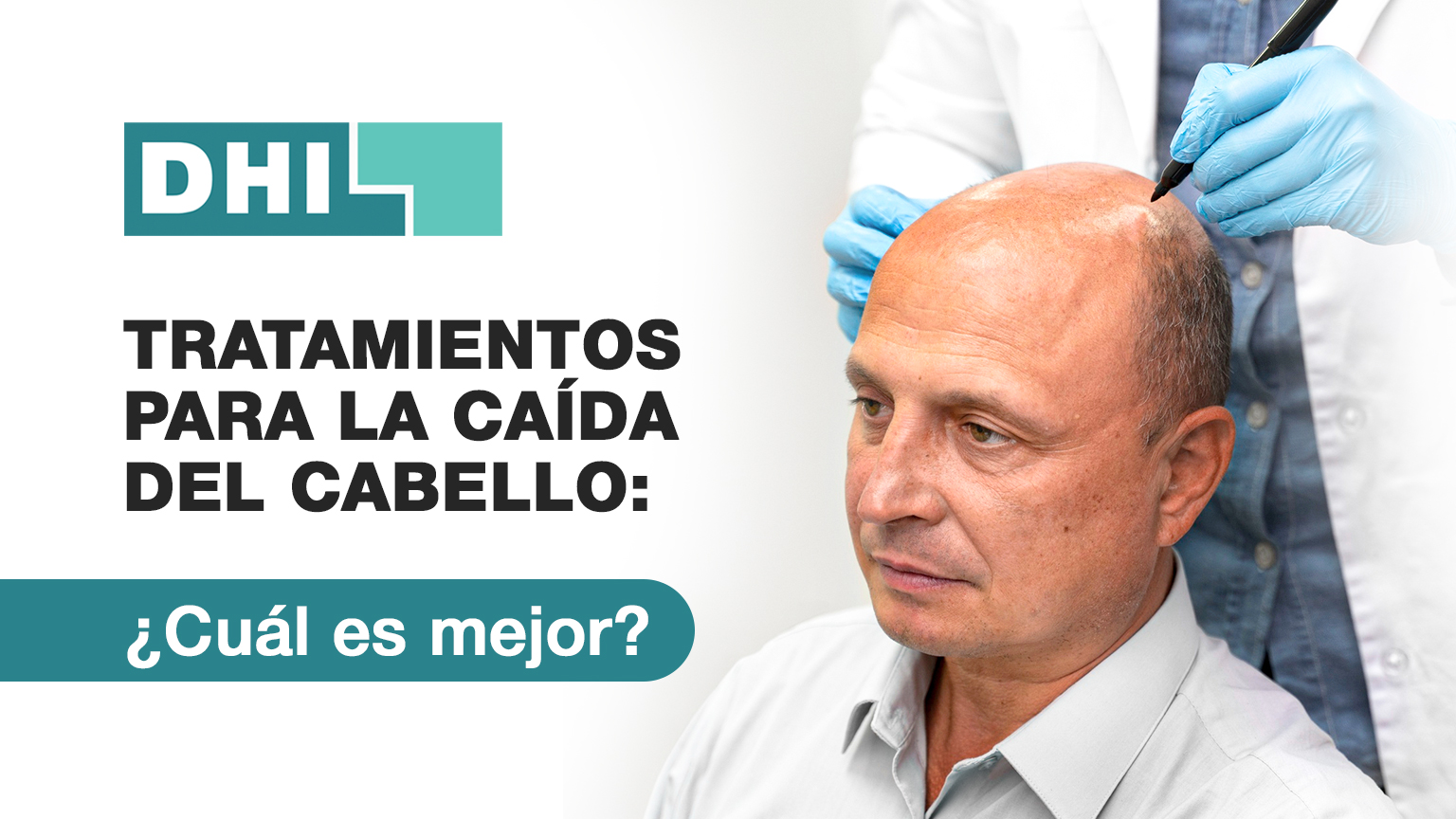 Tratamientos para la caída del cabello: ¿cuál es mejor?