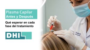 Plasma capilar -Antes y después del tratamiento | DHI Colombia