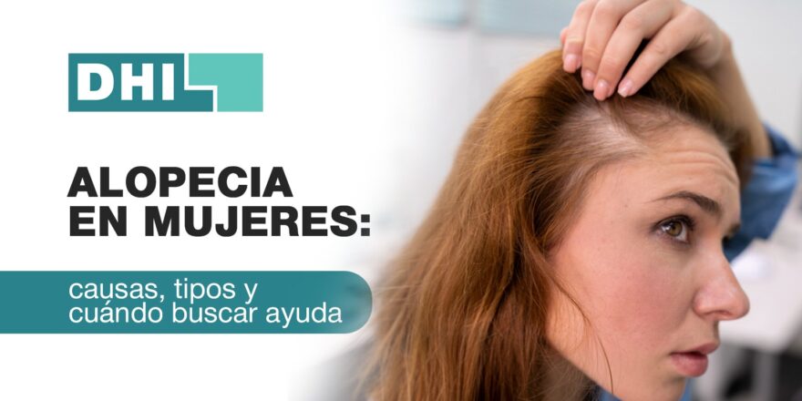 Alopecia en las mujeres: ¿cuándo la caída del cabello deja de ser normal?