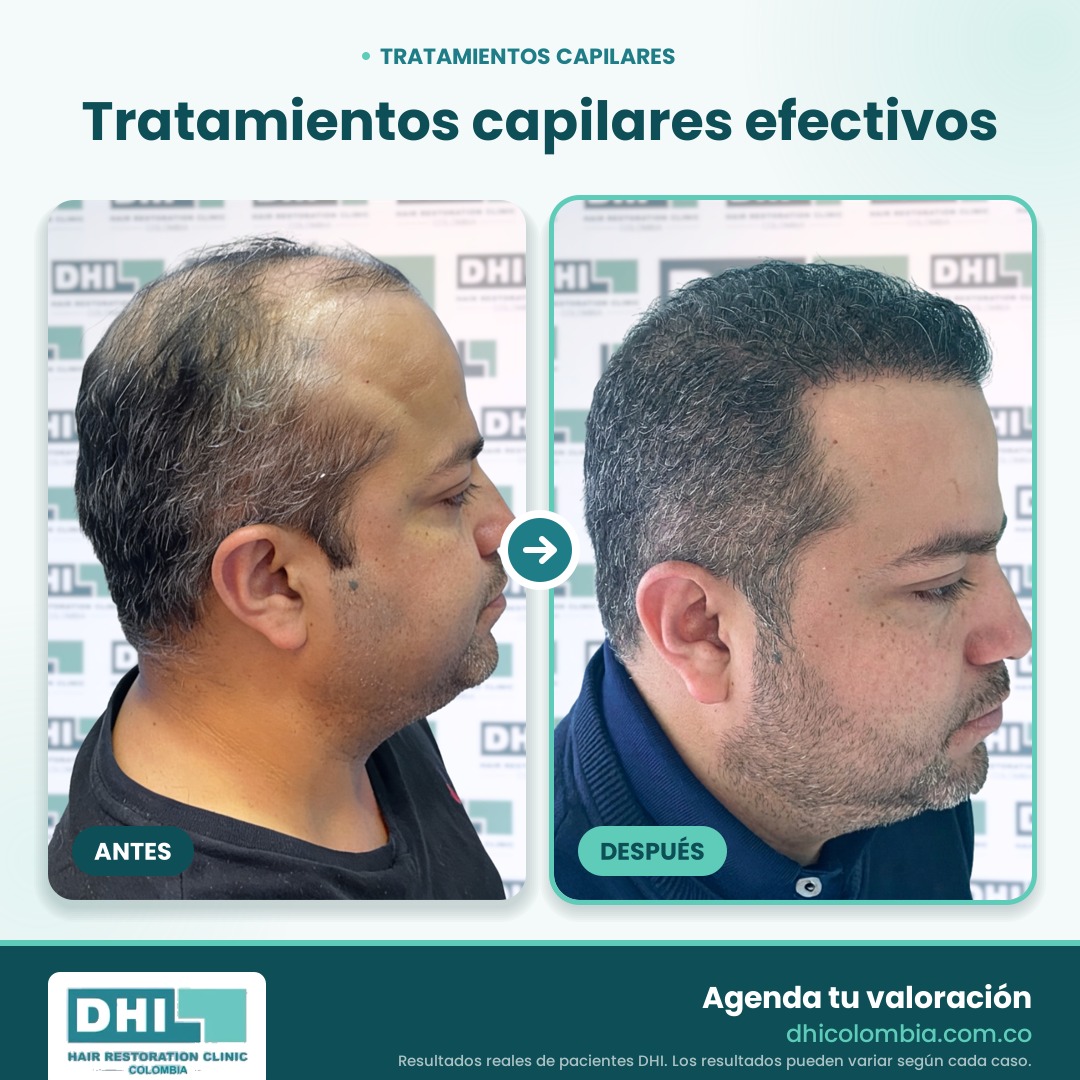 DHI_Antes_Despues_Web_2