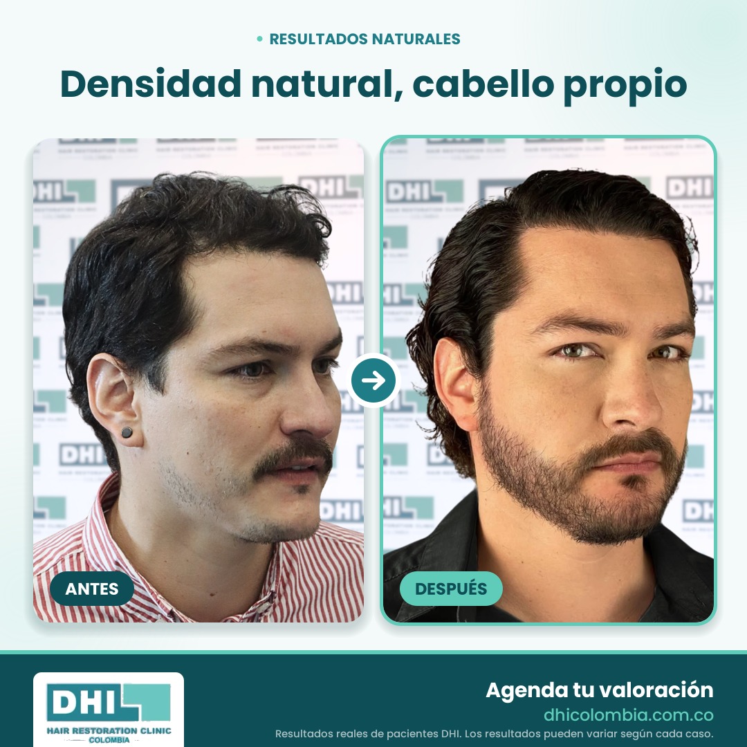 DHI_Antes_Despues_Web_4